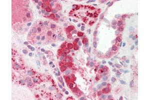 Human Kidney: Formalin-Fixed, Paraffin-Embedded (FFPE).