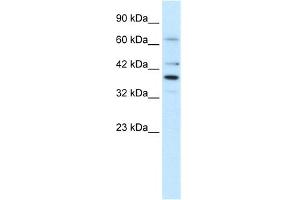 WB Suggested Anti-POU4F3 Antibody Titration:  1. (POU4F3 anticorps  (Middle Region))