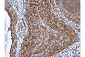 IHC-P Image HAX1 antibody detects HAX1 protein at cytoplasm in rat ovary by immunohistochemical analysis. (HAX1 anticorps)
