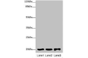 Western blot All lanes: FAIM antibody at 2 μg/mL Lane 1: 293T whole cell lysate Lane 2: Rat gonad tissue Lane 3: Jurkat whole cell lysate Secondary Goat polyclonal to rabbit IgG at 1/10000 dilution Predicted band size: 21, 25, 23 kDa Observed band size: 21 kDa (FAIM anticorps  (AA 1-179))
