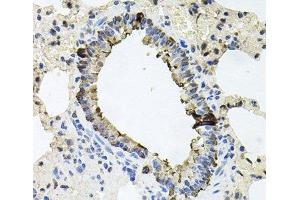 Immunohistochemistry of paraffin-embedded Rat lung using ERBB4 Polyclonal Antibody at dilution of 1:100 (40x lens). (ERBB4 anticorps)