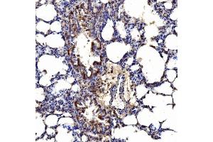 IHC analysis of Gephyrin/GPHN using anti-Gephyrin/GPHN antibody (ABIN7600086). (Gephyrin anticorps  (AA 148-736))