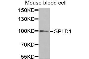 Western blot analysis of extracts of mouse blood, using GPLD1 antibody (ABIN5973975) at 1/1000 dilution. (GPLD1 anticorps)