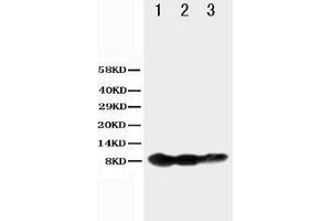Anti-BAFF Receptor antibody, Western blotting Lane 1: Recombinant Human BAFFR Protein 10ng Lane 2: Recombinant Human BAFFR Protein 5ng Lane 3: Recombinant Human BAFFR Protein 2.
