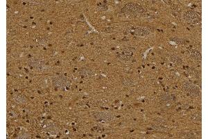 ABIN6276382 at 1/100 staining Rat brain tissue by IHC-P. (TCL1A anticorps  (Internal Region))