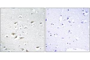 Immunohistochemistry analysis of paraffin-embedded human brain tissue, using ZEB2 Antibody. (ZEB2 anticorps  (AA 71-120))