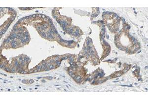 ABIN6269186 at 1/100 staining Human prostate tissue by IHC-P. (TNNI3 anticorps  (N-Term))