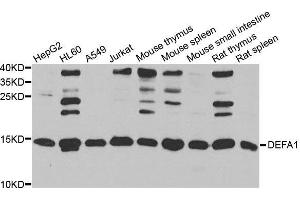 Western blot analysis of extracts of various cell lines, using DEFA1 antibody. (alpha Defensin 1 anticorps  (AA 1-94))