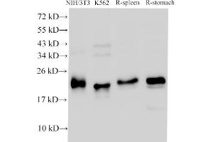 Western Blot analysis of NIH/3T3, K562 cells, Rat spleen and Rat stomach using CDK4 Polyclonal Antibody at dilution of 1:1000 (CDK4 anticorps)