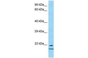 Image no. 1 for anti-Transcription Factor 23 (TCF23) (AA 92-141) antibody (ABIN6748386) (TCF23 anticorps  (AA 92-141))