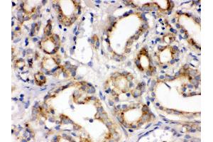 Immunohistochemistry (Paraffin-embedded Sections) (IHC (p)) image for anti-Frizzled Family Receptor 1 (Fzd1) (AA 369-400), (C-Term) antibody (ABIN3042412) (FZD1 anticorps  (C-Term))
