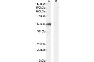 (ABIN5539901) (0. (PAX1 anticorps  (AA 318-329))