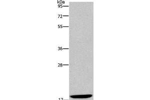 Western Blot analysis of Hela cell using KLLN Polyclonal Antibody at dilution of 1:350 (KLLN anticorps)
