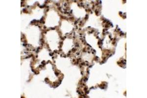 Immunohistochemistry of ECRG2 in rat lung tissue with ECRG2 antibody at 5 ug/mL.