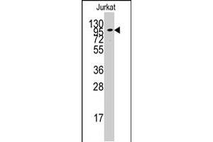 Western blot analysis of ADCY2 polyclonal antibody  in Jurkat cell line lysates (35 ug/lane). (ADCY2 anticorps  (C-Term))