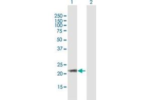 Western Blot analysis of ARL6 expression in transfected 293T cell line by ARL6 MaxPab polyclonal antibody.