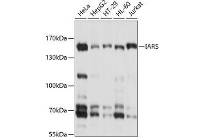 Western blot analysis of extracts of various cell lines, using IARS antibody (ABIN6132301, ABIN6142113, ABIN6142114 and ABIN6214344) at 1:1000 dilution. (IARS anticorps  (AA 1158-1262))