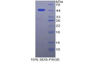 SDS-PAGE (SDS) image for Fibroblast Growth Factor 7 (FGF7) (AA 32-194) protein (His tag,GST tag) (ABIN1877549)