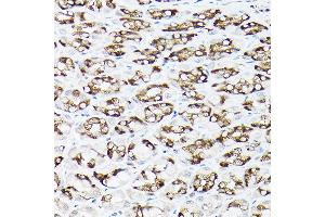 Immunohistochemistry of paraffin-embedded rat stomach using SLC8 Rabbit pAb (ABIN6132664, ABIN6148050, ABIN6148052 and ABIN6221228) at dilution of 1:100 (40x lens).