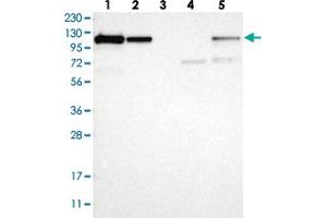 Western blot analysis of Lane 1: RT-4, Lane 2: U-251 MG, Lane 3: Human Plasma, Lane 4: Liver, Lane 5: Tonsil with NFKB2 polyclonal antibody  at 1:250-1:500 dilution. (NFKB2 anticorps)