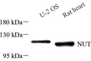 Western blot analysis of NUT (ABIN7074932) at dilution of 1: 1000 (NUT anticorps)