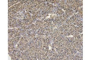 IHC analysis of ALDOB using anti-ALDOB antibody (ABIN7602563). (ALDOB anticorps  (AA 85-364))