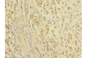 Immunohistochemistry (IHC) image for anti-Claudin 18 (CLDN18) (AA 20-80) antibody (ABIN6038124)