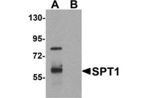 Western blot analysis of TYW3 in A549 cell lysate with TYW3 antibody at 1 μg/ml in (A) the absence and (B) the presence of blocking peptide. (TYW3 anticorps  (Center))