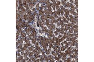 Immunohistochemical staining of human liver with GPR179 polyclonal antibody  shows distinct cytoplasmic positivity in hepatocytes at 1:200-1:500 dilution. (GPR179 anticorps)