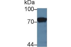 Detection of F1+2 in Rat Kidney lysate using Polyclonal Antibody to Prothrombin Fragment 1+2 (F1+2) (Prothrombin Fragment 1+2 anticorps  (AA 44-323))