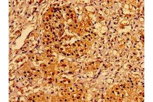 Immunohistochemistry of paraffin-embedded human adrenal gland tissue using ABIN7143732 at dilution of 1:100 (AAGAB anticorps  (AA 191-315))