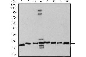 Western blot analysis using RAN mouse mAb against Hela (1), NIH/3T3 (2), A431 (3), C6 (4), Jurkat (5), Hela (6), COS7 (7), and Jurkat (8) cell lysate. (RAN anticorps  (AA 1-216))