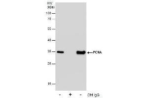 IP Image Immunoprecipitation of PCBP2 protein from HeLa whole cell extracts using 5 μg of PCBP2 antibody, Western blot analysis was performed using PCBP2 antibody, EasyBlot anti-Rabbit IgG  was used as a secondary reagent. (PCNA anticorps)