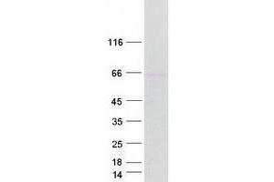Validation with Western Blot