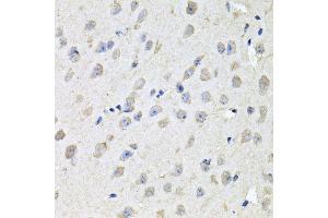 Immunohistochemistry of paraffin-embedded mouse brain using CHCHD3 antibody (ABIN5995784) at dilution of 1/100 (40x lens). (CHCHD3 anticorps)