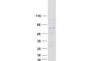 SIVA1, Apoptosis-Inducing Factor (SIVA1) (Transcript Variant 1) protein (Myc-DYKDDDDK Tag)