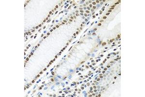 Immunohistochemistry of paraffin-embedded human stomach using PTBP1 antibody (ABIN5995415) at dilution of 1/100 (40x lens). (PTBP1 anticorps)