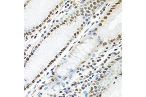 Immunohistochemistry of paraffin-embedded human stomach using PTBP1 antibody (ABIN5995415) at dilution of 1/100 (40x lens).