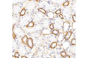 Immunohistochemistry of paraffin embedded rat kidney using ATP1A1 (ABIN7073154) at dilution of 1: 500 (400x lens) (ATPase (Na/K) anticorps)