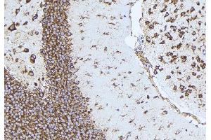 ABIN6277161 at 1/100 staining Mouse brain tissue by IHC-P. (NPPB anticorps  (Internal Region))