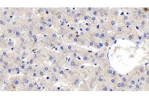 Detection of FGF23 in Human Liver Tissue using Polyclonal Antibody to Fibroblast Growth Factor 23 (FGF23) (FGF23 anticorps  (AA 79-160))