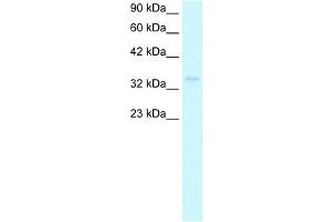 WB Suggested Anti-NPM1 Antibody Titration:  1. (NPM1 anticorps  (Middle Region))