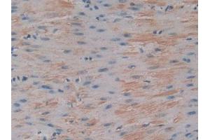 DAB staining on IHC-P; Samples: Mouse Stomach Tissue (IGFBP6 anticorps  (AA 46-238))