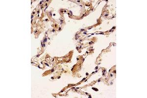 Paraformaldehyde-fixed, paraffin embedded human lung tissue, Antigen retrieval by boiling in sodium citrate buffer (pH6.