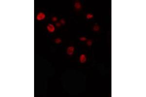 ABIN6274336 staining Hela cells by IF/ICC. (KLF anticorps)