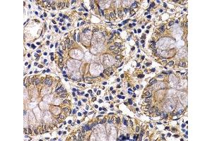 Immunohistochemistry of paraffin-embedded Human colon using ARRB2 Polyclonal Antibody at dilution of 1:200 (40x lens). (Arrestin 3 anticorps)