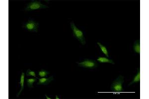 Immunofluorescence of monoclonal antibody to EEA1 on HeLa cell.