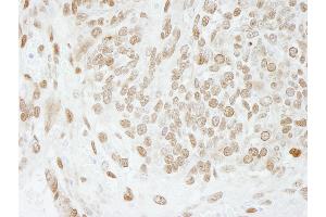 Immunohistochemistry (IHC) image for anti-Activated RNA Polymerase II Transcriptional Coactivator p15 (SUB1) (AA 77-127) antibody (ABIN7448719) (SUB1 anticorps  (AA 77-127))