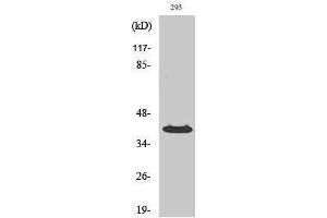 Western Blotting (WB) image for anti-Protein Phosphatase, Mg2+/Mn2+ Dependent, 1K (PPM1K) (Internal Region) antibody (ABIN6281862)