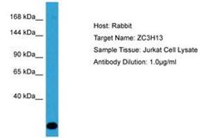 Image no. 1 for anti-Zinc Finger CCCH-Type Containing 13 (ZC3H13) (AA 1455-1504) antibody (ABIN6750587) (ZC3H13 anticorps  (AA 1455-1504))
